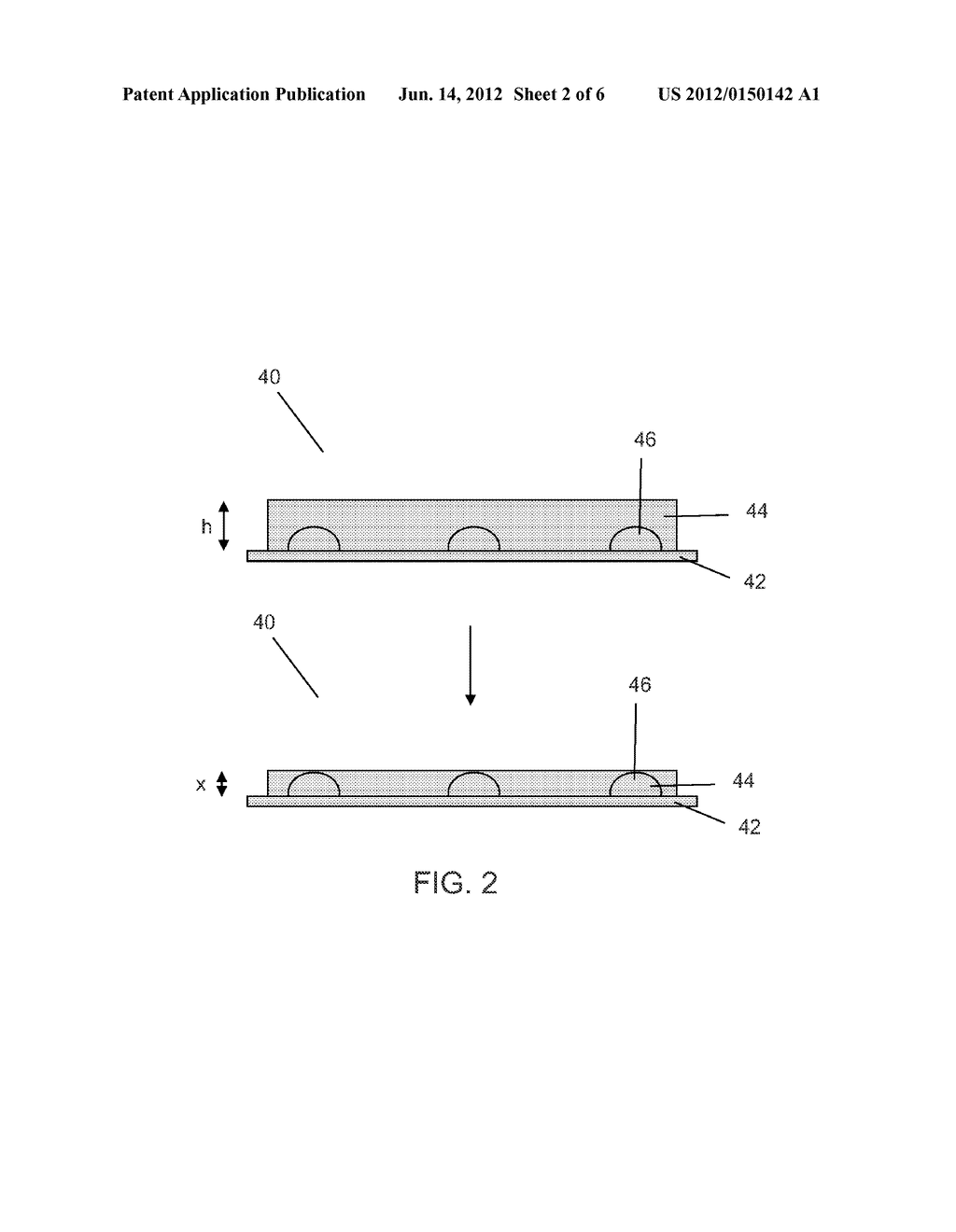 Drug Eluting Balloons with Ability for Double Treatment - diagram, schematic, and image 03