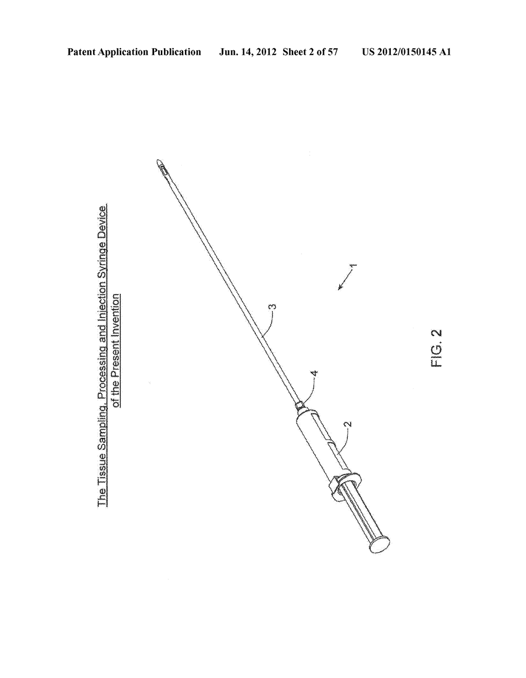 METHODS OF TISSUE SAMPLING, COLLECTION, PROCESSING AND RE-INJECTION USING     MODULAR, DISPOSABLE TISSUE ASPIRATION, PROCESSING, COLLECTION AND/OR     RE-INJECTION COMPONENTS - diagram, schematic, and image 03