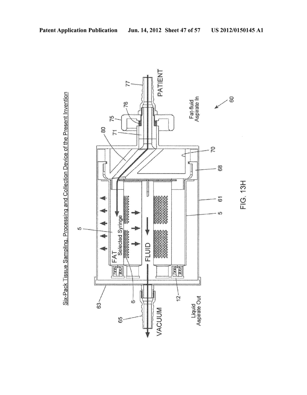 METHODS OF TISSUE SAMPLING, COLLECTION, PROCESSING AND RE-INJECTION USING     MODULAR, DISPOSABLE TISSUE ASPIRATION, PROCESSING, COLLECTION AND/OR     RE-INJECTION COMPONENTS - diagram, schematic, and image 48