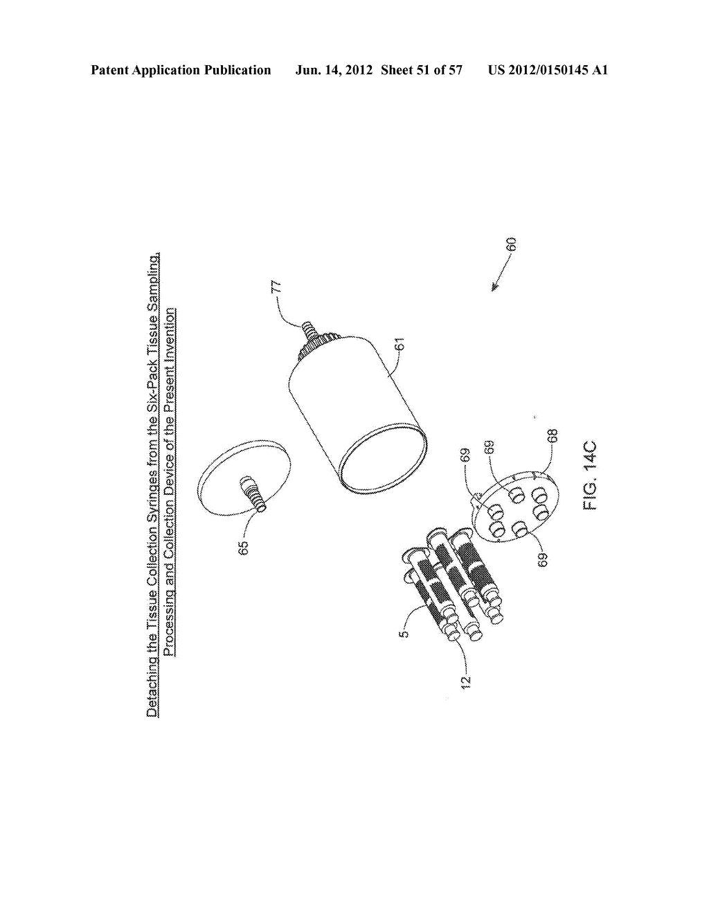 METHODS OF TISSUE SAMPLING, COLLECTION, PROCESSING AND RE-INJECTION USING     MODULAR, DISPOSABLE TISSUE ASPIRATION, PROCESSING, COLLECTION AND/OR     RE-INJECTION COMPONENTS - diagram, schematic, and image 52