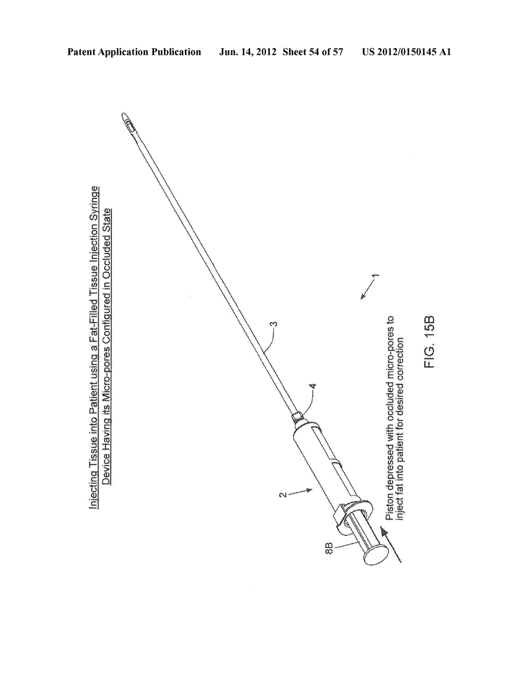 METHODS OF TISSUE SAMPLING, COLLECTION, PROCESSING AND RE-INJECTION USING     MODULAR, DISPOSABLE TISSUE ASPIRATION, PROCESSING, COLLECTION AND/OR     RE-INJECTION COMPONENTS - diagram, schematic, and image 55