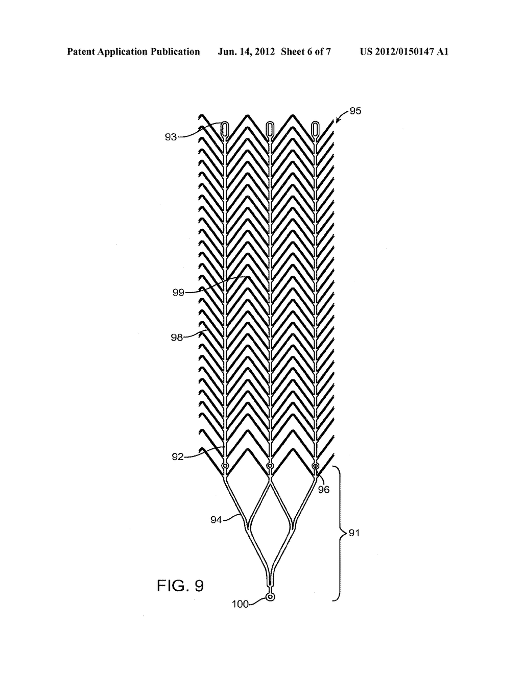 SYSTEM AND METHOD FOR TREATING ISCHEMIC STROKE - diagram, schematic, and image 07