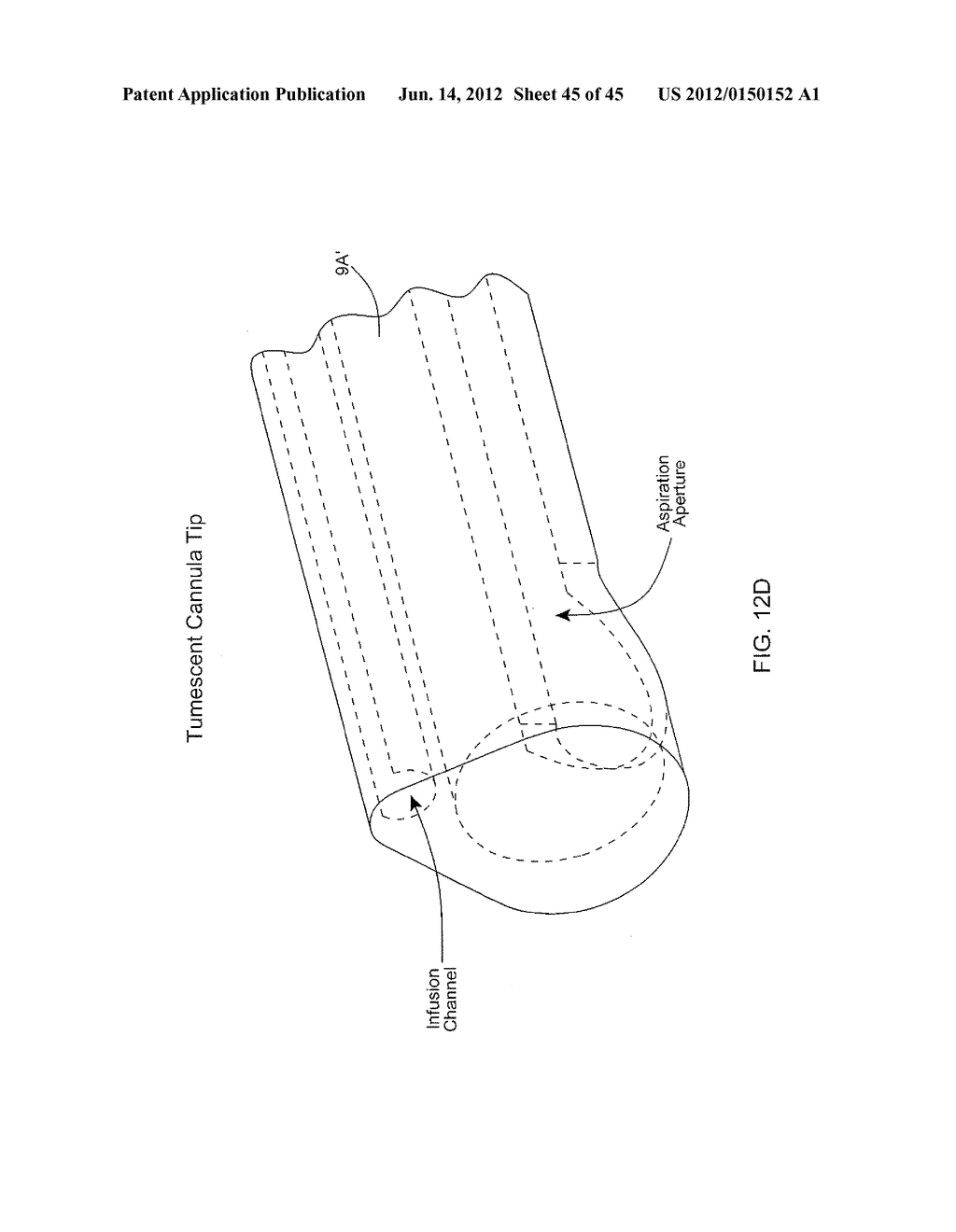 DISPOSABLE CANNULA BASE DEVICE FOR INSERTION WITHIN A GUIDE TUBE IN A     HAND-SUPPORTABLE POWER-ASSISTED TISSUE ASPIRATION INSTRUMENT - diagram, schematic, and image 46