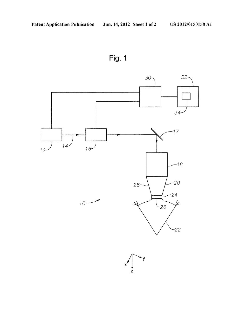 Device and process for machining the cornea of a human eye with focused     pulsed laser radiation - diagram, schematic, and image 02