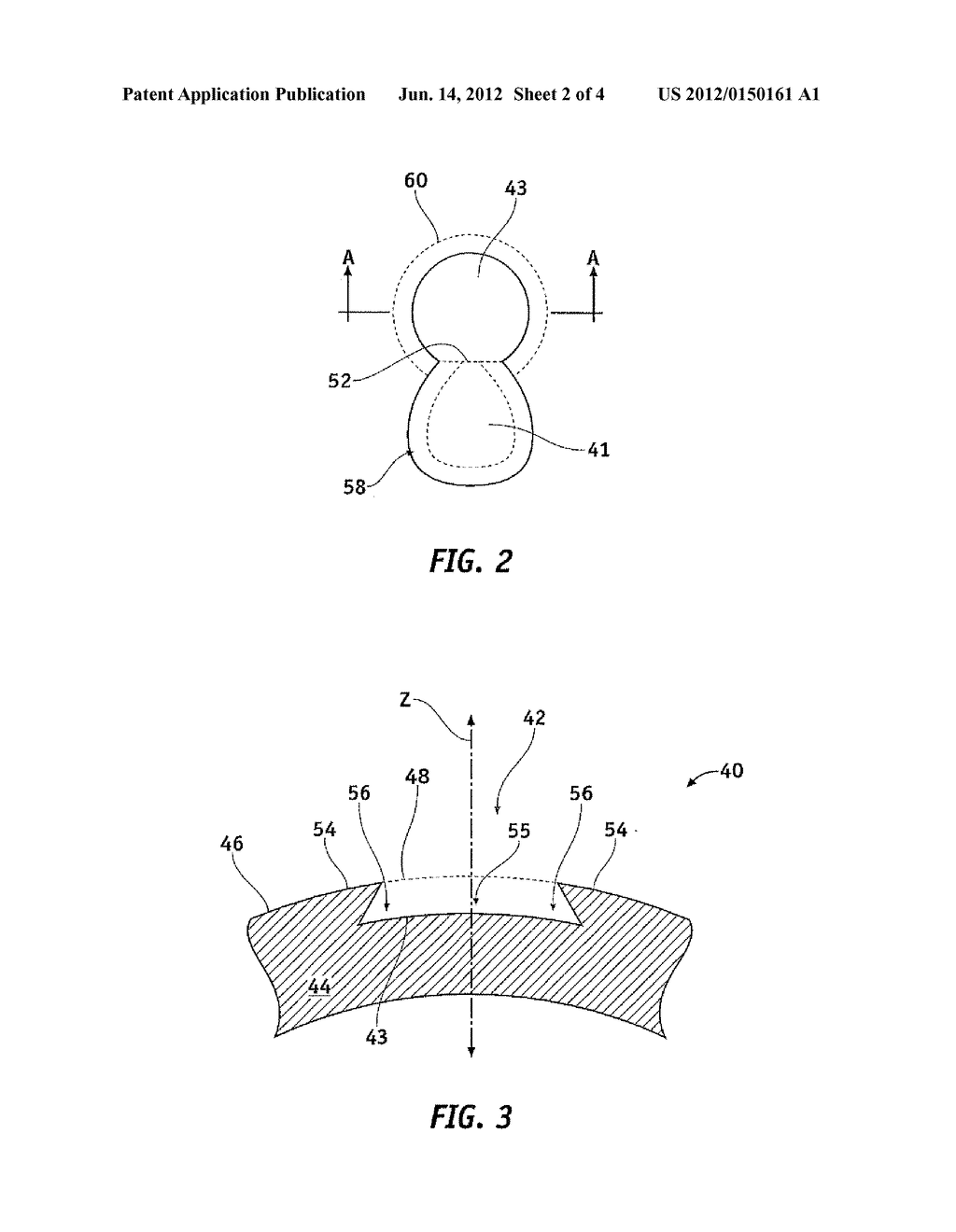 SYSTEM AND METHOD FOR INCISING MATERIAL - diagram, schematic, and image 03