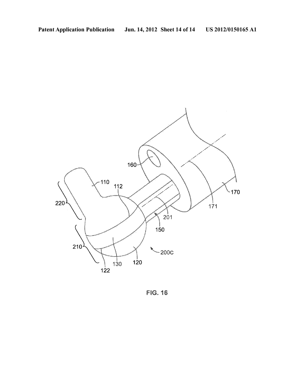 Bipolar Electrosurgical Device - diagram, schematic, and image 15