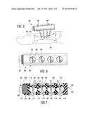 External fixation apparatus with angularly adjustable drill guiding and     pin clamping means diagram and image