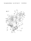 External fixation apparatus with angularly adjustable drill guiding and     pin clamping means diagram and image