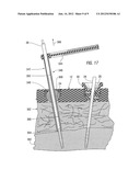 External fixation apparatus with angularly adjustable drill guiding and     pin clamping means diagram and image