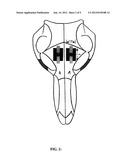 ABSORBABLE BONE ADHESIVE APPLICATOR diagram and image