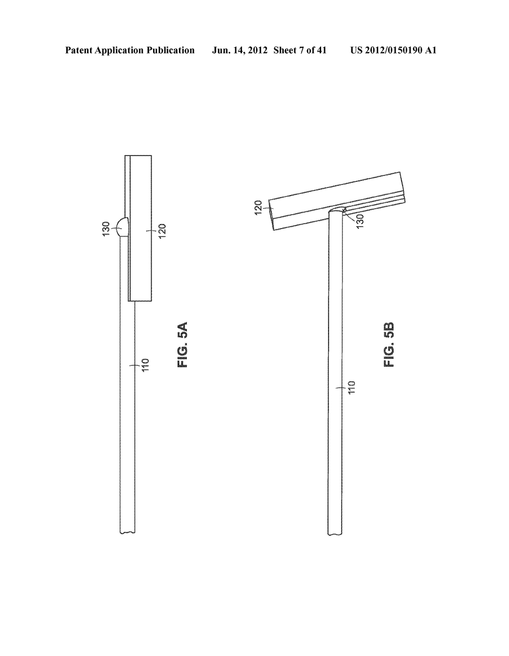 Systems and Methods for Implant Removal - diagram, schematic, and image 08