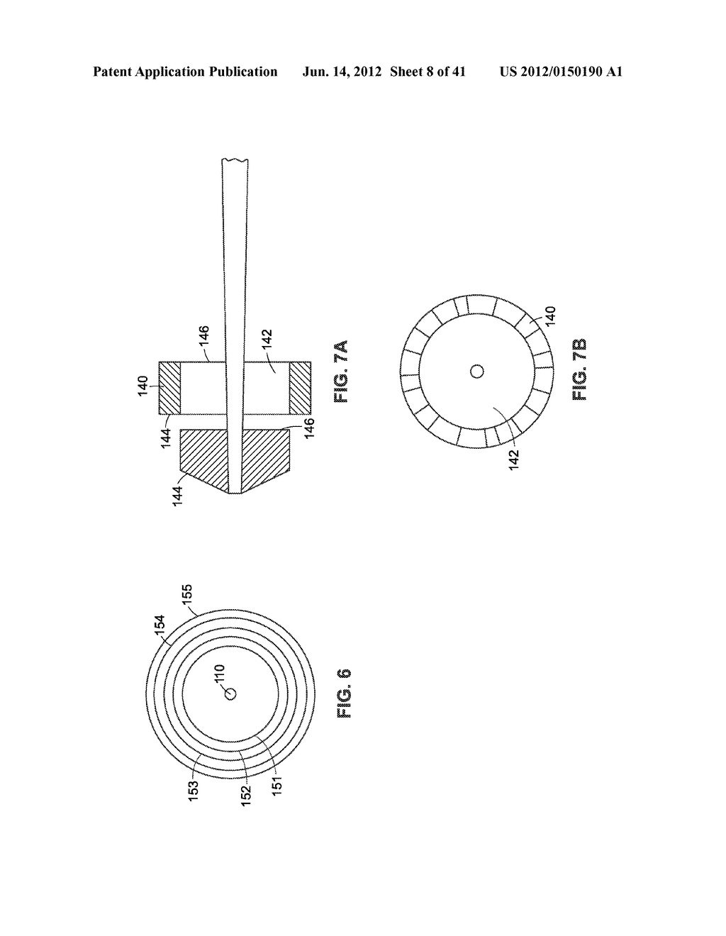 Systems and Methods for Implant Removal - diagram, schematic, and image 09