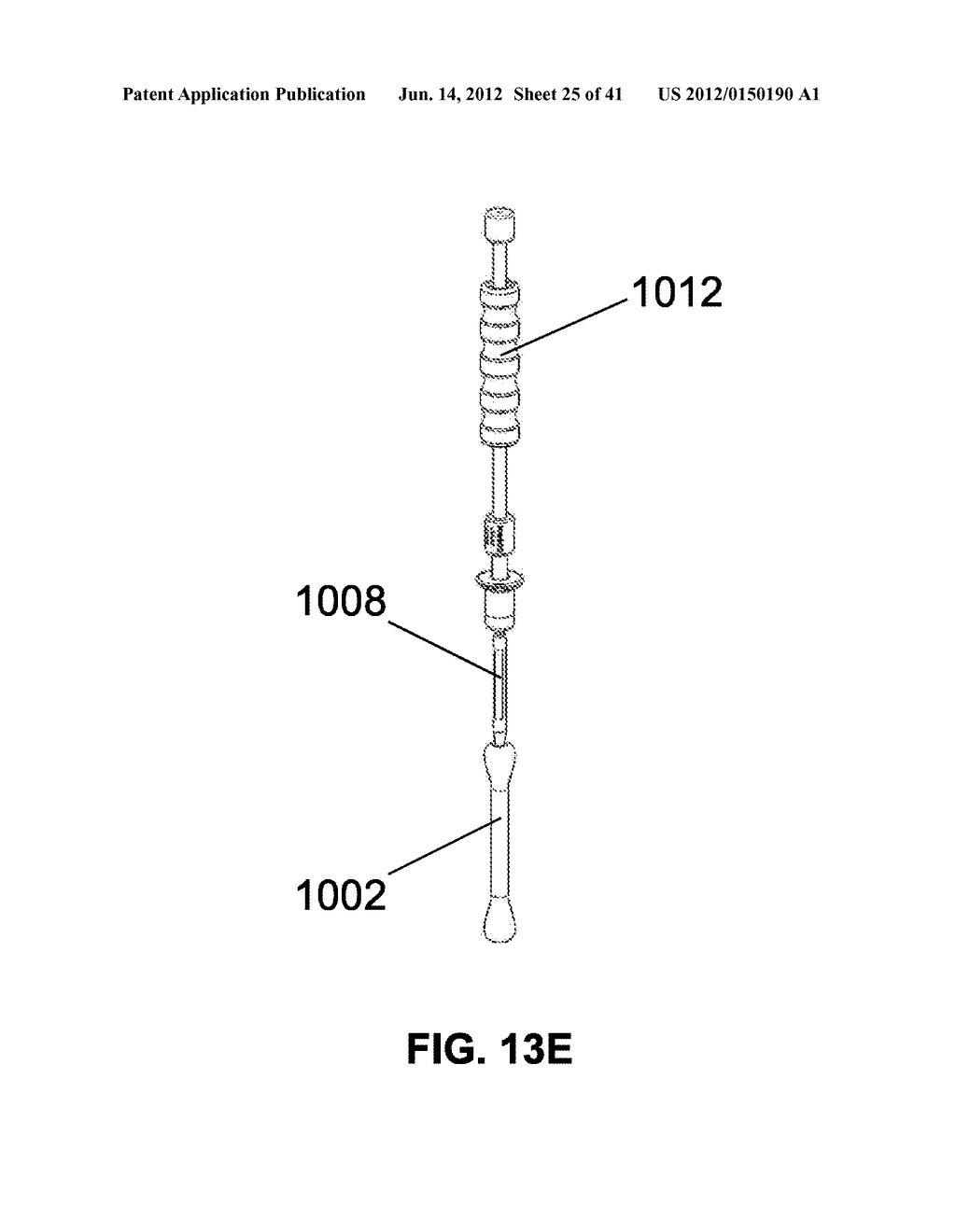 Systems and Methods for Implant Removal - diagram, schematic, and image 26