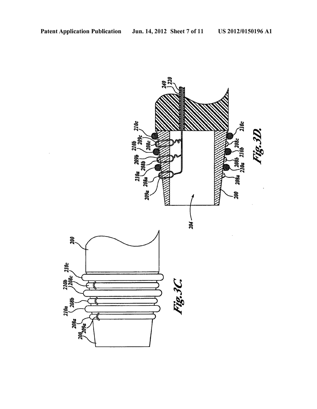 ENDOSCOPIC APPARATUS WITH INTEGRATED VARICEAL LIGATION DEVICE - diagram, schematic, and image 08