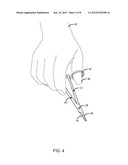 Ergonomically Correct Needle Holder diagram and image