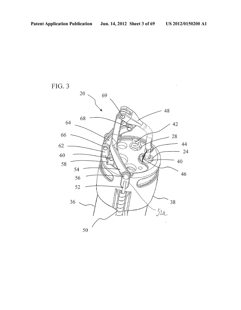 Endoscopic Needle Assembly - diagram, schematic, and image 04