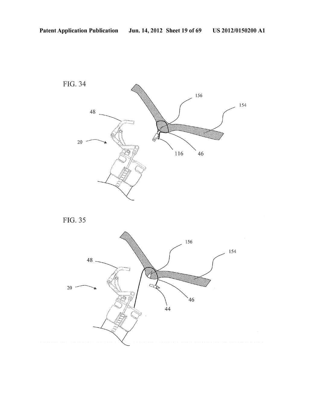 Endoscopic Needle Assembly - diagram, schematic, and image 20