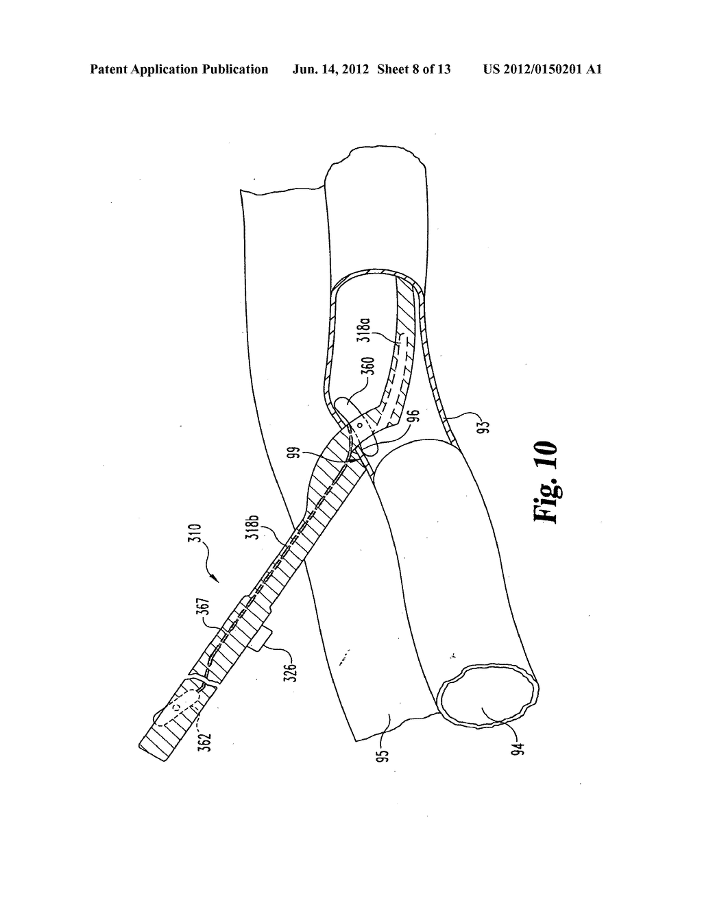 VASCULAR SUTURING DEVICE WITH NEEDLE CAPTURE - diagram, schematic, and image 09