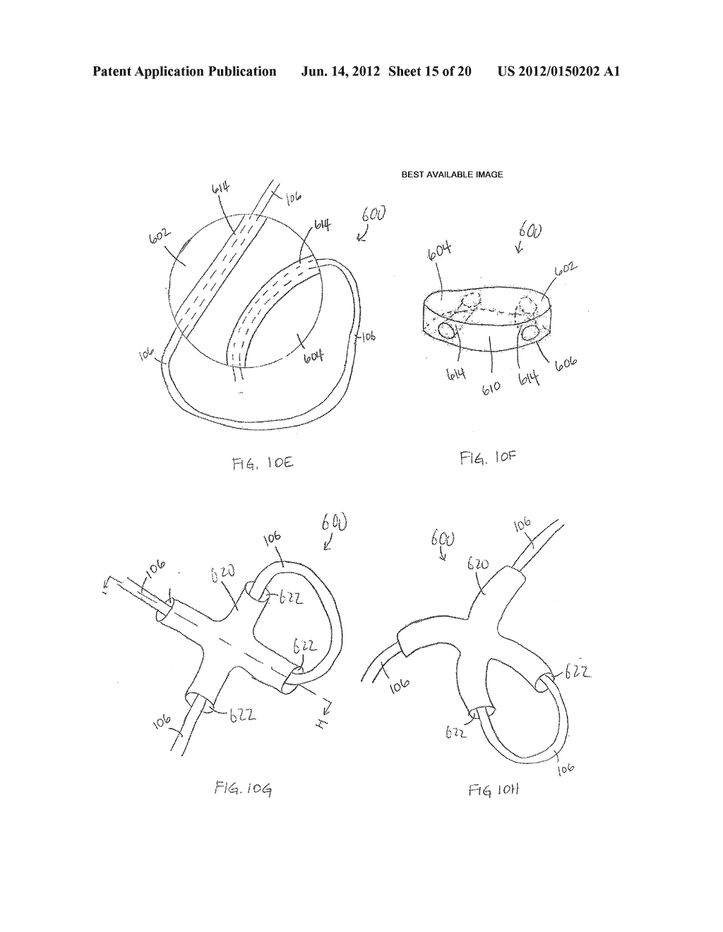 DEVICES CONTAINING A SUTURE SLEEVE AND METHODS OF MAKING AND USING - diagram, schematic, and image 16