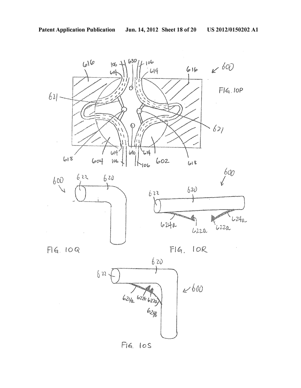 DEVICES CONTAINING A SUTURE SLEEVE AND METHODS OF MAKING AND USING - diagram, schematic, and image 19