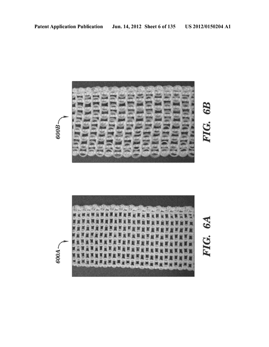 IMPLANTABLE SILK PROSTHETIC DEVICE AND USES THEREOF - diagram, schematic, and image 07