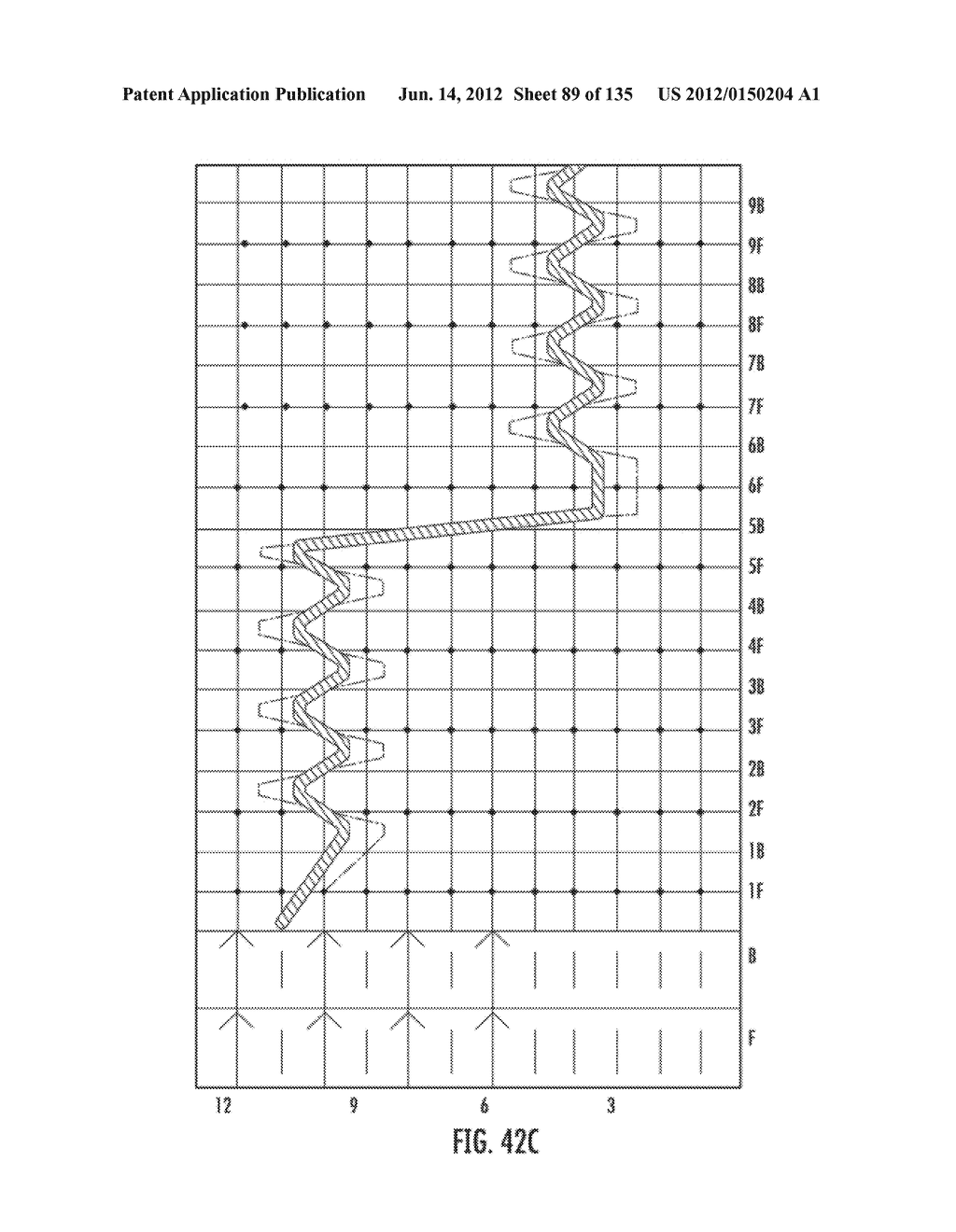 IMPLANTABLE SILK PROSTHETIC DEVICE AND USES THEREOF - diagram, schematic, and image 90