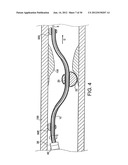 ROTATIONAL DEVICE WITH ECCENTRIC ABRASIVE ELEMENT AND METHOD OF USE diagram and image