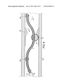 ROTATIONAL DEVICE WITH ECCENTRIC ABRASIVE ELEMENT AND METHOD OF USE diagram and image