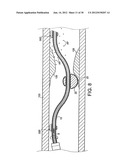 ROTATIONAL DEVICE WITH ECCENTRIC ABRASIVE ELEMENT AND METHOD OF USE diagram and image