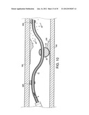 ROTATIONAL DEVICE WITH ECCENTRIC ABRASIVE ELEMENT AND METHOD OF USE diagram and image