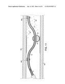 ROTATIONAL DEVICE WITH ECCENTRIC ABRASIVE ELEMENT AND METHOD OF USE diagram and image