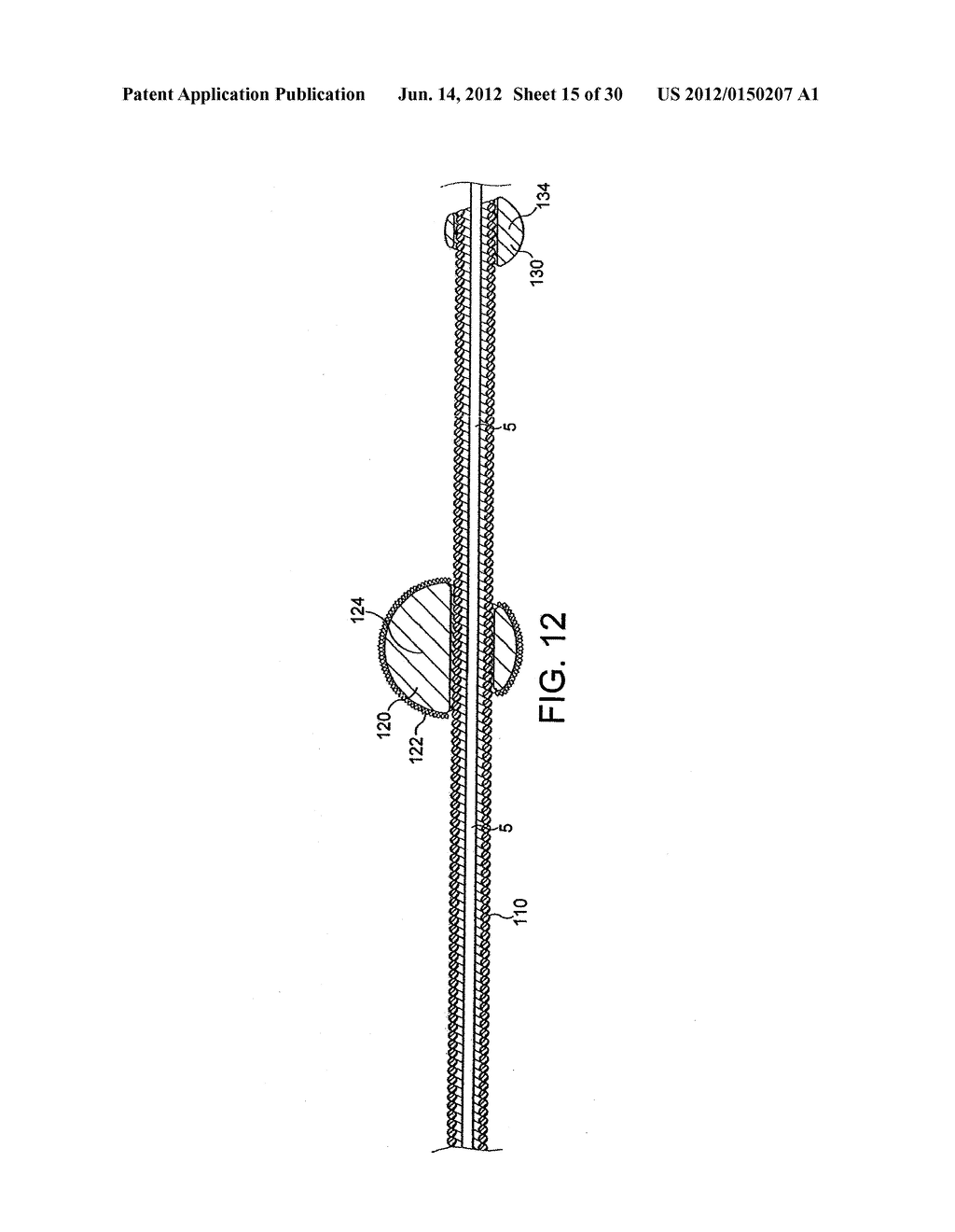 ROTATIONAL DEVICE WITH ECCENTRIC ABRASIVE ELEMENT AND METHOD OF USE - diagram, schematic, and image 16