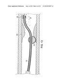 ROTATIONAL DEVICE WITH ECCENTRIC ABRASIVE ELEMENT AND METHOD OF USE diagram and image