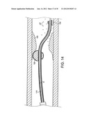 ROTATIONAL DEVICE WITH ECCENTRIC ABRASIVE ELEMENT AND METHOD OF USE diagram and image