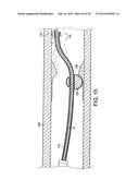 ROTATIONAL DEVICE WITH ECCENTRIC ABRASIVE ELEMENT AND METHOD OF USE diagram and image