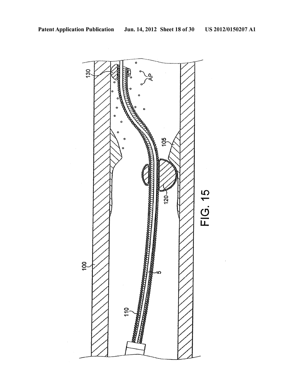 ROTATIONAL DEVICE WITH ECCENTRIC ABRASIVE ELEMENT AND METHOD OF USE - diagram, schematic, and image 19