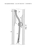 ROTATIONAL DEVICE WITH ECCENTRIC ABRASIVE ELEMENT AND METHOD OF USE diagram and image