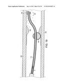 ROTATIONAL DEVICE WITH ECCENTRIC ABRASIVE ELEMENT AND METHOD OF USE diagram and image