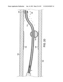 ROTATIONAL DEVICE WITH ECCENTRIC ABRASIVE ELEMENT AND METHOD OF USE diagram and image