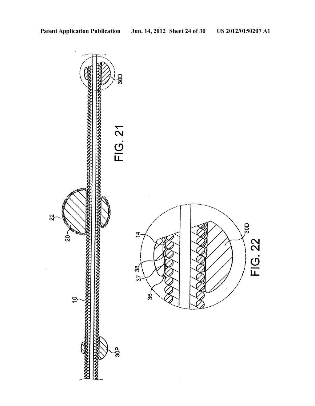 ROTATIONAL DEVICE WITH ECCENTRIC ABRASIVE ELEMENT AND METHOD OF USE - diagram, schematic, and image 25