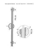 ROTATIONAL DEVICE WITH ECCENTRIC ABRASIVE ELEMENT AND METHOD OF USE diagram and image