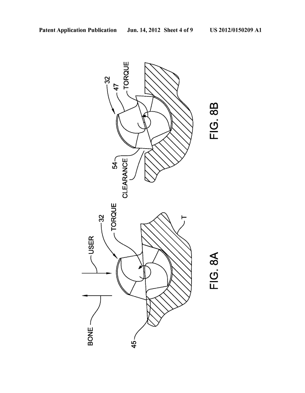 RIBBED SURGICAL BUR - diagram, schematic, and image 05