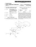 INFLATABLE, STEERABLE BALLOON FOR ELEVATION OF TISSUE WITHIN A BODY diagram and image