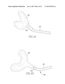 INFLATABLE, STEERABLE BALLOON FOR ELEVATION OF TISSUE WITHIN A BODY diagram and image