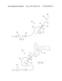 INFLATABLE, STEERABLE BALLOON FOR ELEVATION OF TISSUE WITHIN A BODY diagram and image