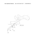 INFLATABLE, STEERABLE BALLOON FOR ELEVATION OF TISSUE WITHIN A BODY diagram and image