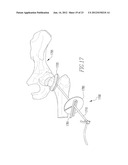 INFLATABLE, STEERABLE BALLOON FOR ELEVATION OF TISSUE WITHIN A BODY diagram and image