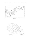 INFLATABLE, STEERABLE BALLOON FOR ELEVATION OF TISSUE WITHIN A BODY diagram and image