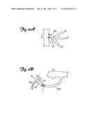 EMBOLIC PROTECTION DEVICES HAVING SHORT LANDING ZONES diagram and image