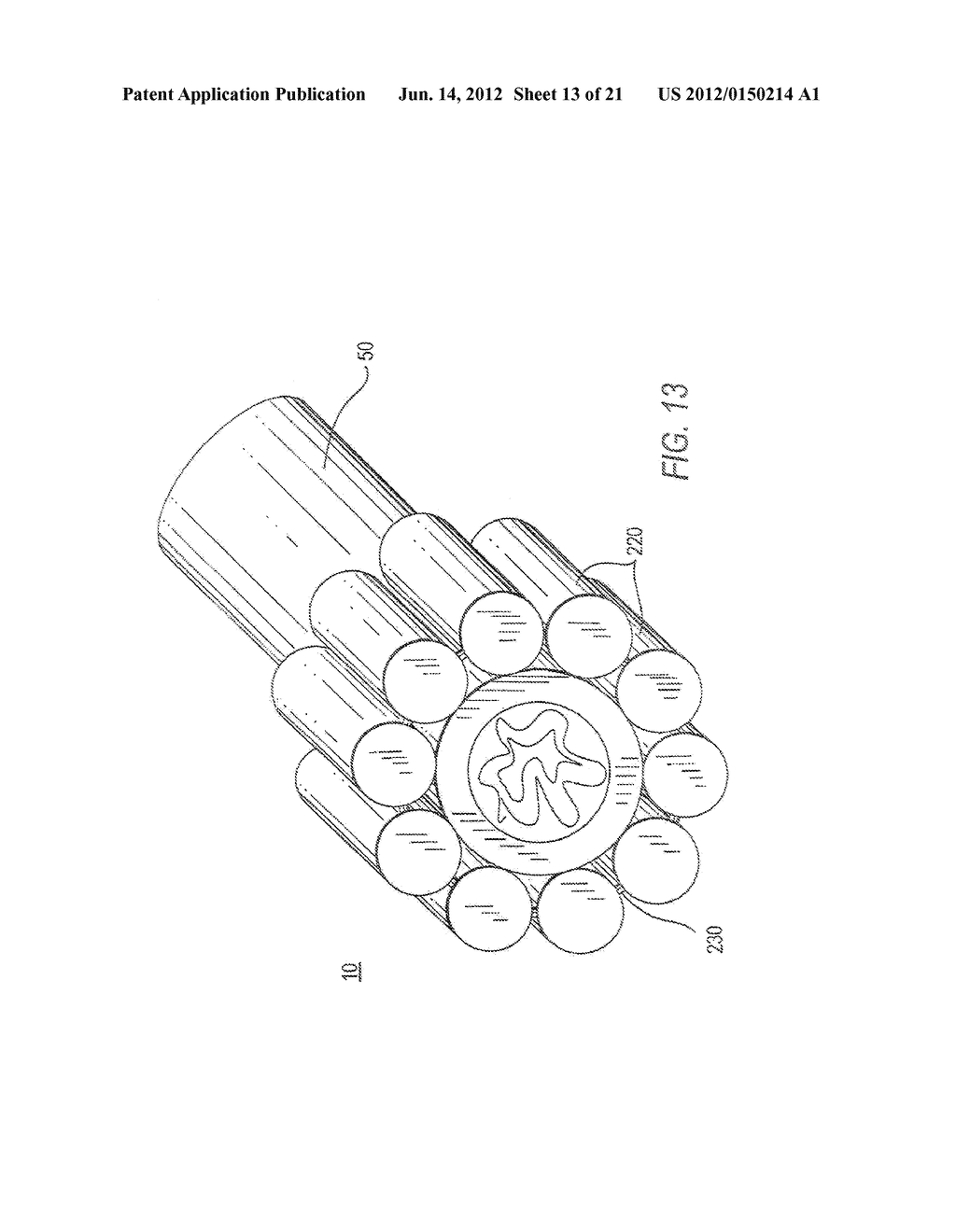 METHODS AND APPARATUS FOR TREATING BODY TISSUE SPHINCTERS AND THE LIKE - diagram, schematic, and image 14